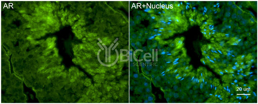 AR (NR3C4) Antibody - Western Blot Validated