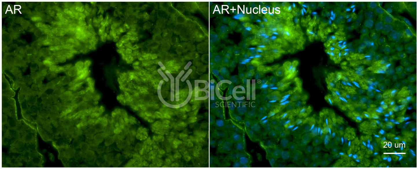 AR (NR3C4) Antibody