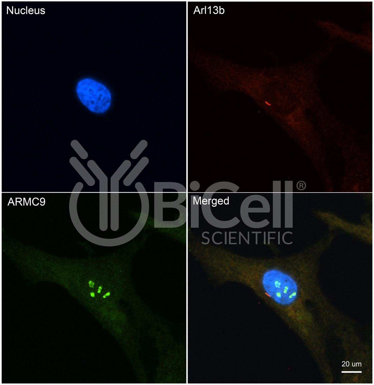 ARMC9 (Human) Antibody - FFPE Validated