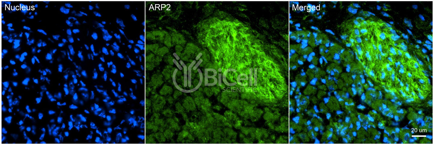 ACTR2 (ARP2) Antibody - Western Blot Validated