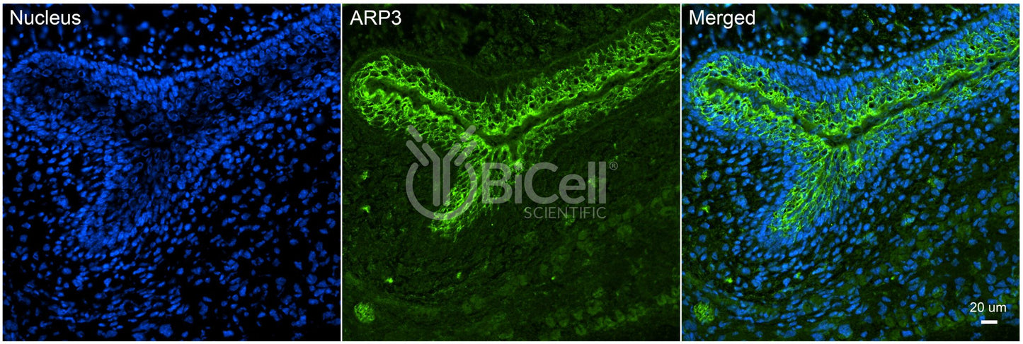 ACTR3 (ARP3) Antibody - FFPE Validated