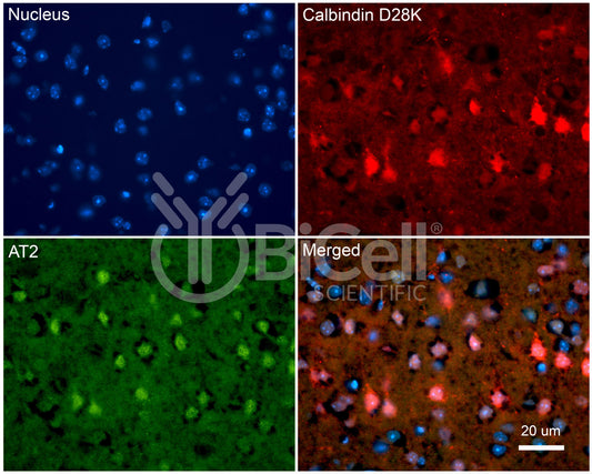 AGTR2 (AT2) Antibody