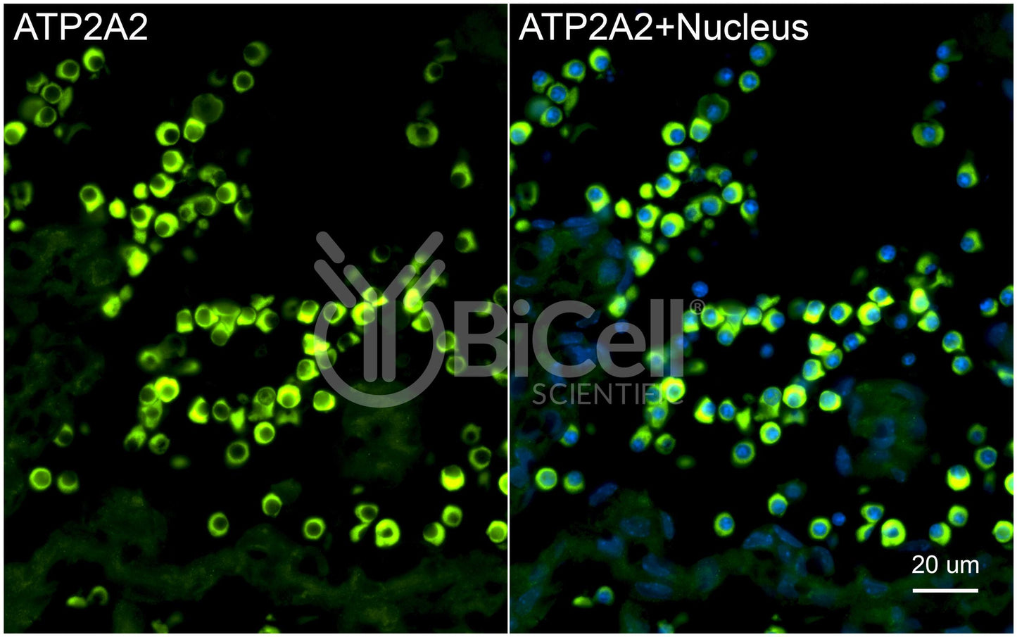 ATP2A2 (SERCA2) Antibody - Western Blot Validated