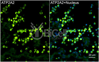 ATP2A2 (SERCA2) Antibody - Western Blot Validated