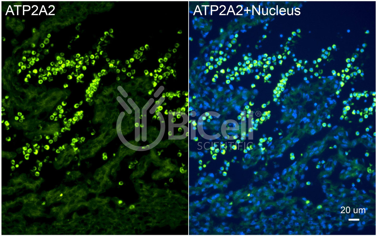 ATP2A2 (SERCA2) Antibody - Western Blot Validated