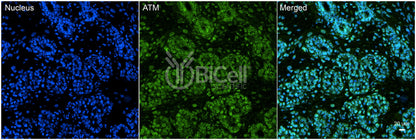 ATM Antibody - Western Blot Validated