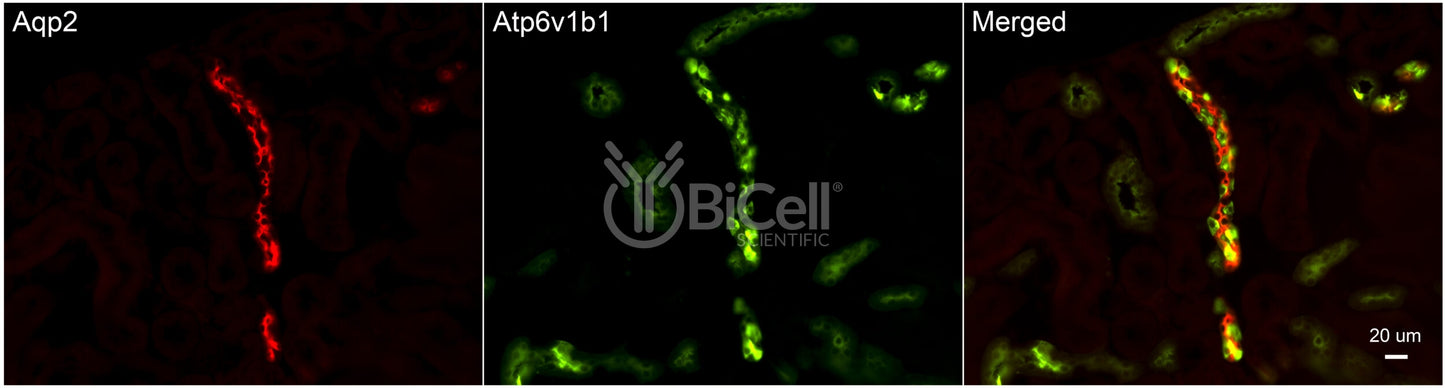 ATP6V1B1 (ATP6B1) Antibody - Western Blot Validated