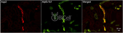 ATP6V1B1 (ATP6B1) Antibody - Western Blot Validated