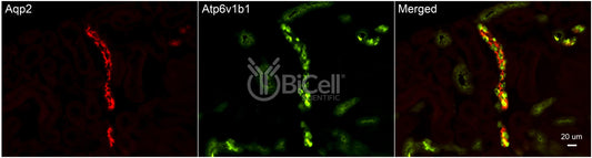 ATP6V1B1 (ATP6B1) Antibody