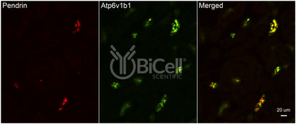ATP6V1B1 (ATP6B1) Antibody - Western Blot Validated