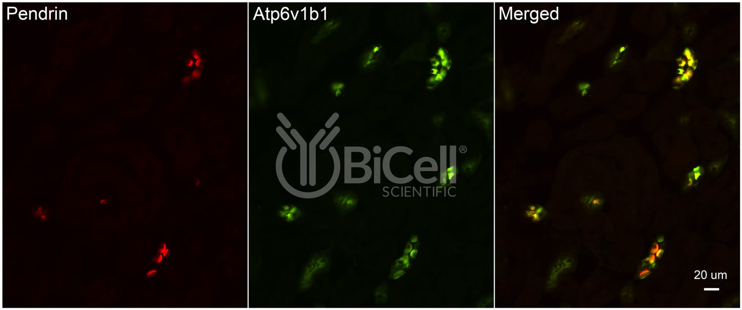 ATP6V1B1 (ATP6B1) Antibody