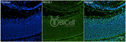 BCL2L1 (Bcl-X) Antibody - FFPE Validated