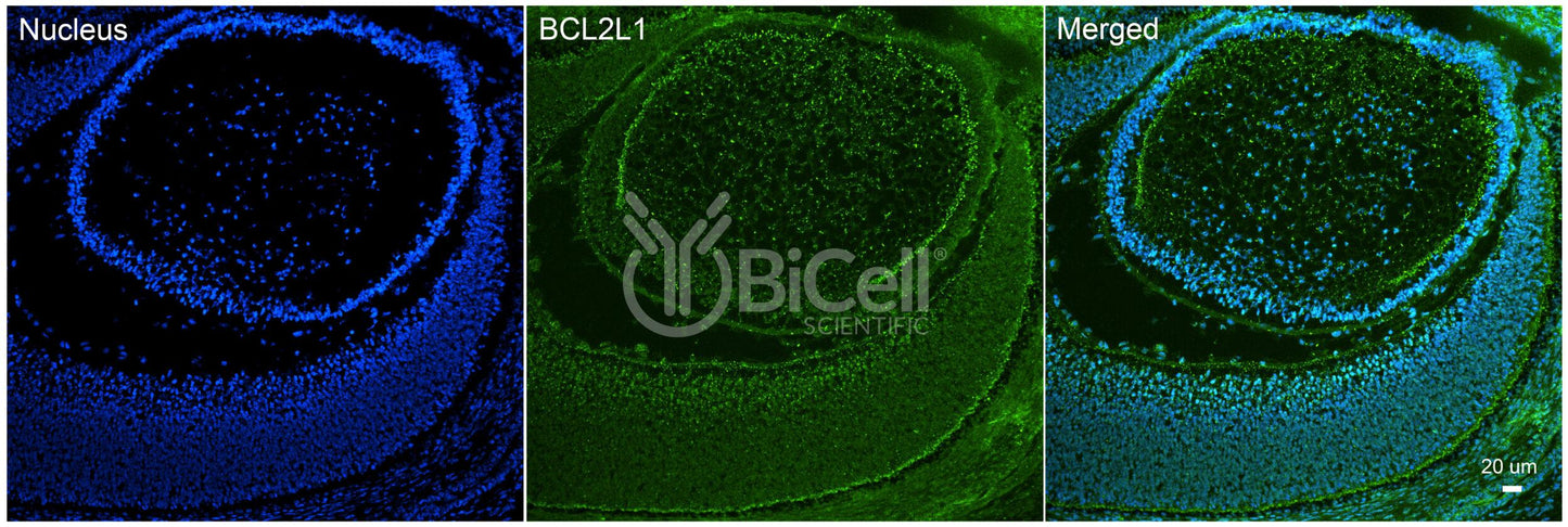 BCL2L1 (Bcl-X) Antibody - FFPE Validated