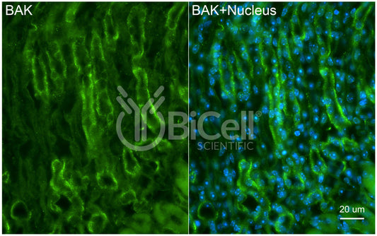 BAK (BAK1 or BCL2L7) Antibody