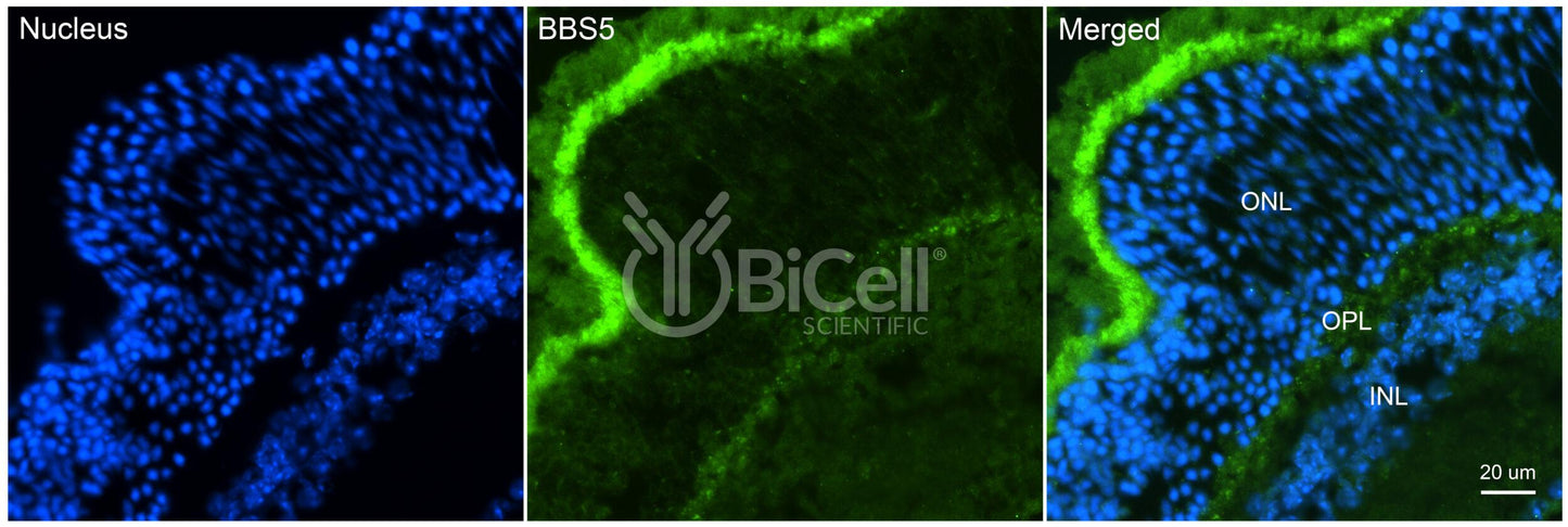 BBS5 (N-Terminus) Antibody
