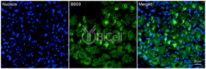 BBS9 (PTHB1) Antibody