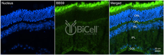 BBS9 (PTHB1) Antibody - FFPE Validated