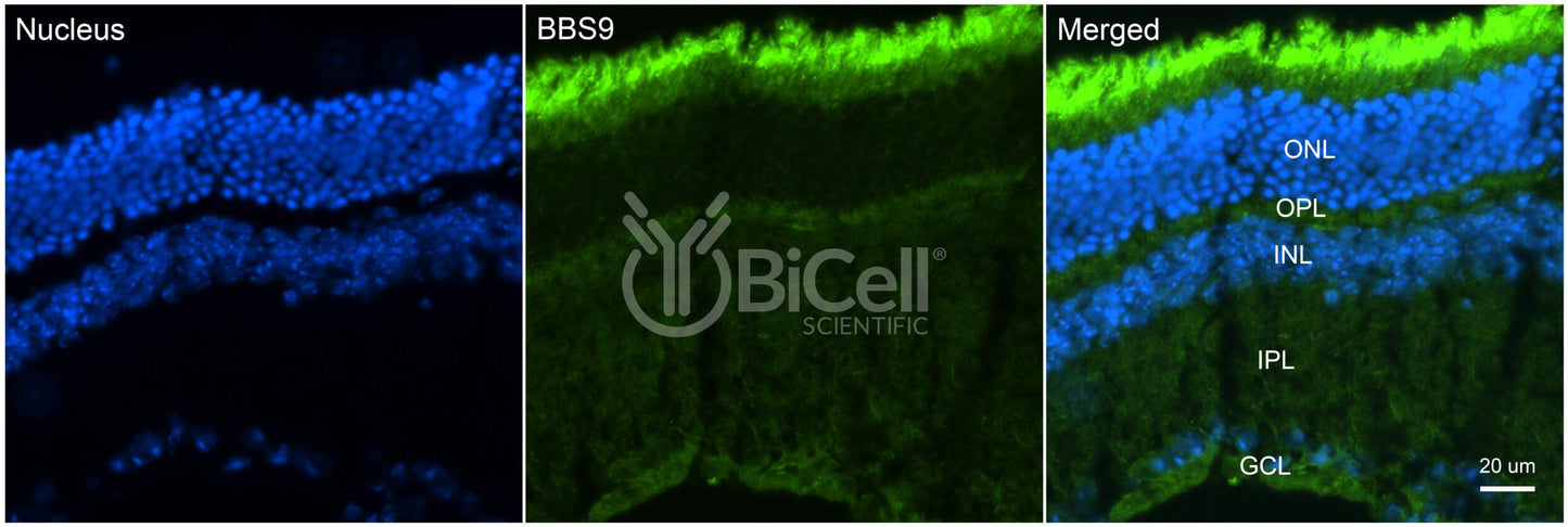 BBS9 (PTHB1) Antibody