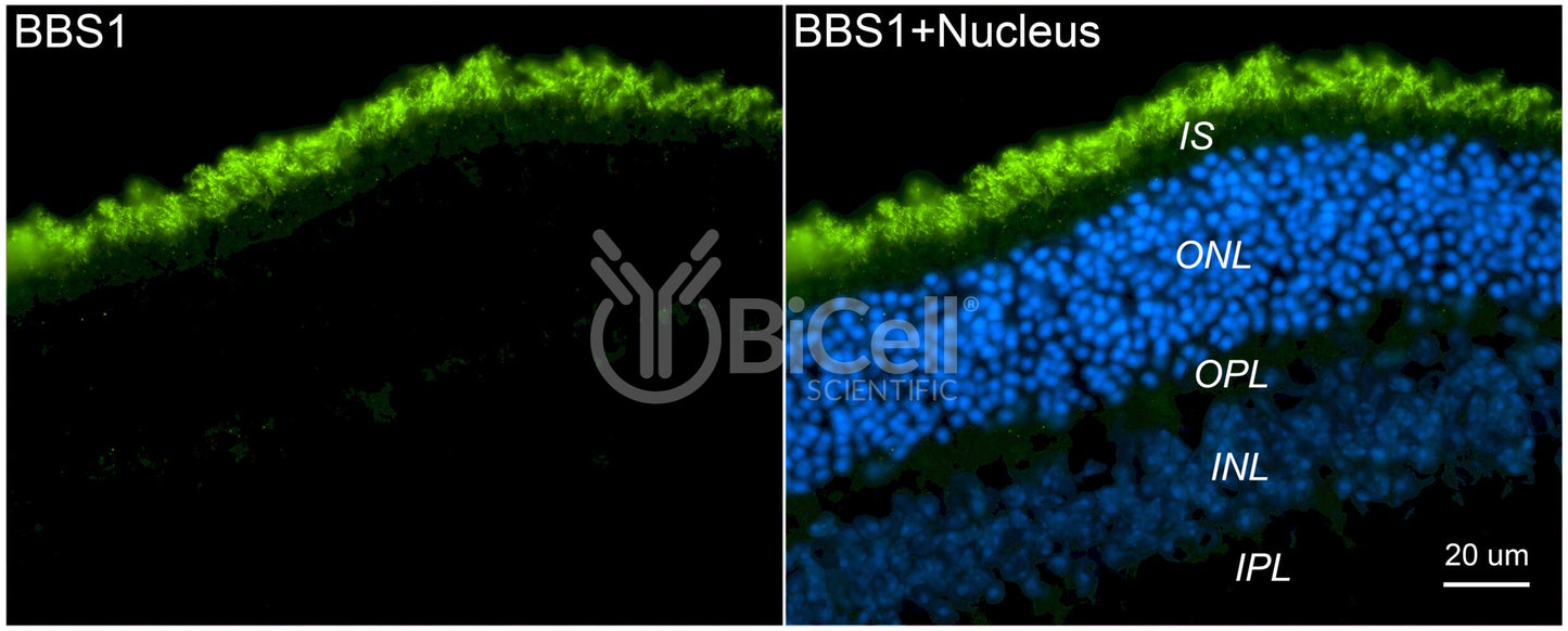 BBS1 Antibody (C-Terminus)