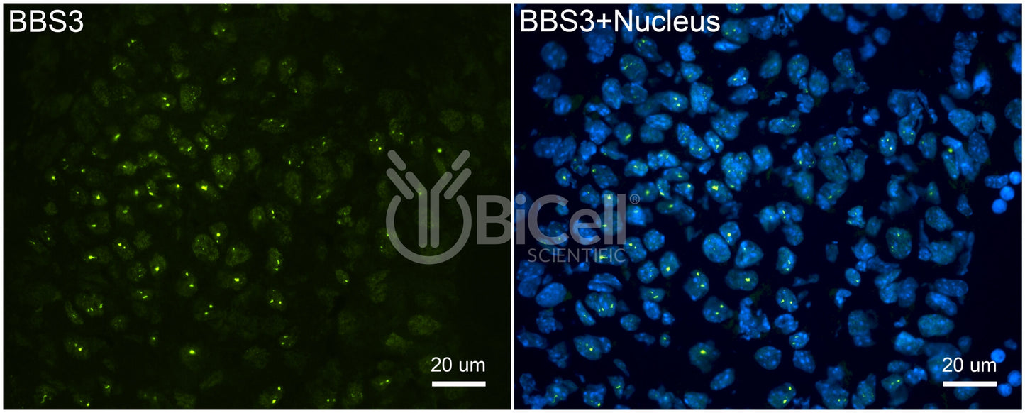 BBS3 (ARL6) Antibody - Western Blot Validated