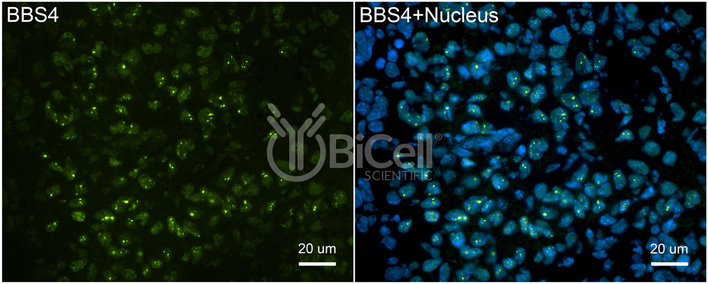 BBS4 Antibody - Western Blot Validated