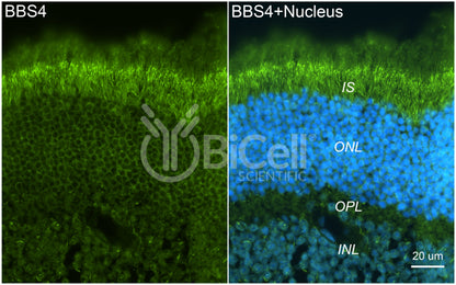 BBS4 Antibody - FFPE Validated