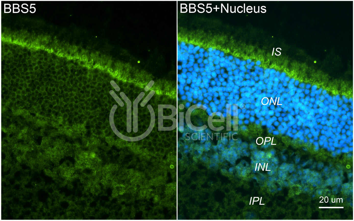 BBS5 (C-Terminus) Antibody - Western Blot Validated