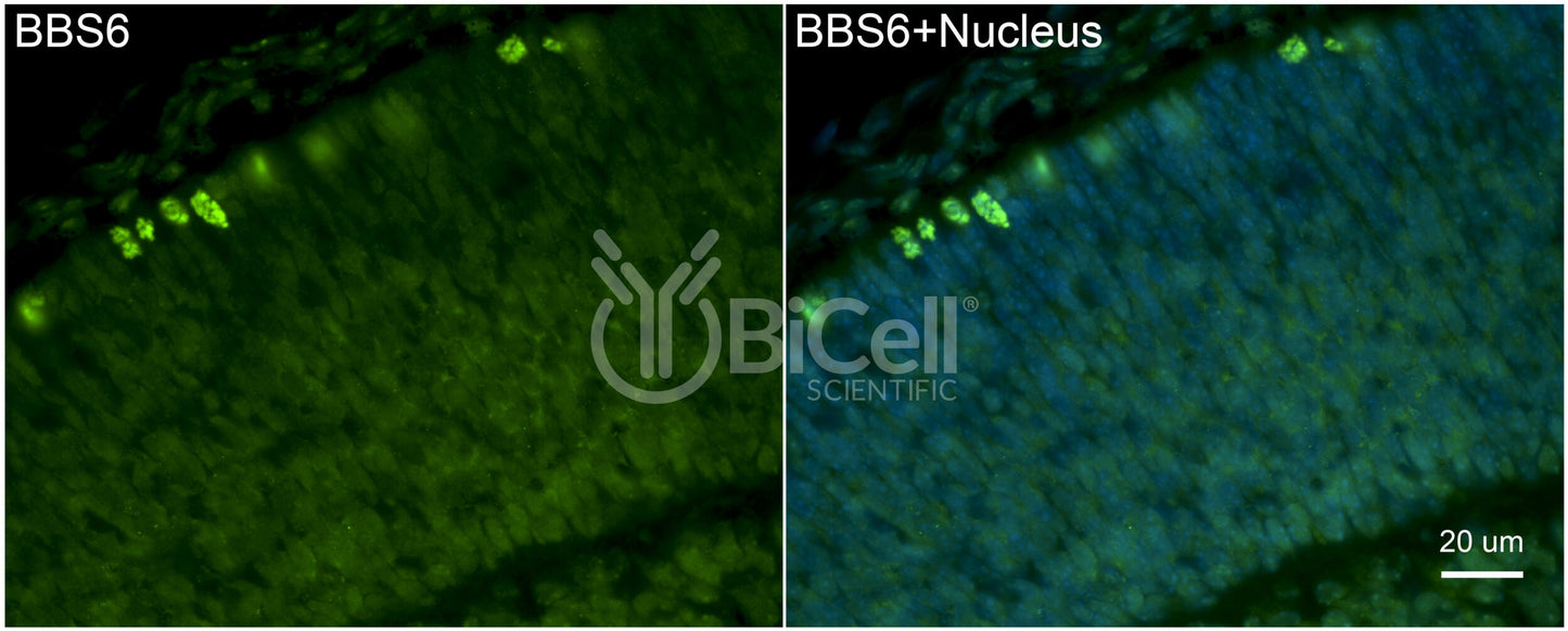 BBS6 Antibody - Western Blot Validated