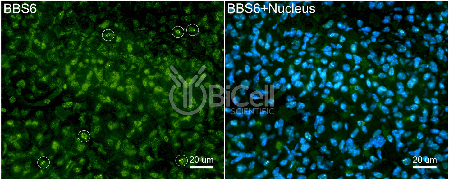 BBS6 Antibody - Western Blot Validated