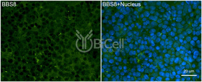 BBS8 (TTC8) Antibody