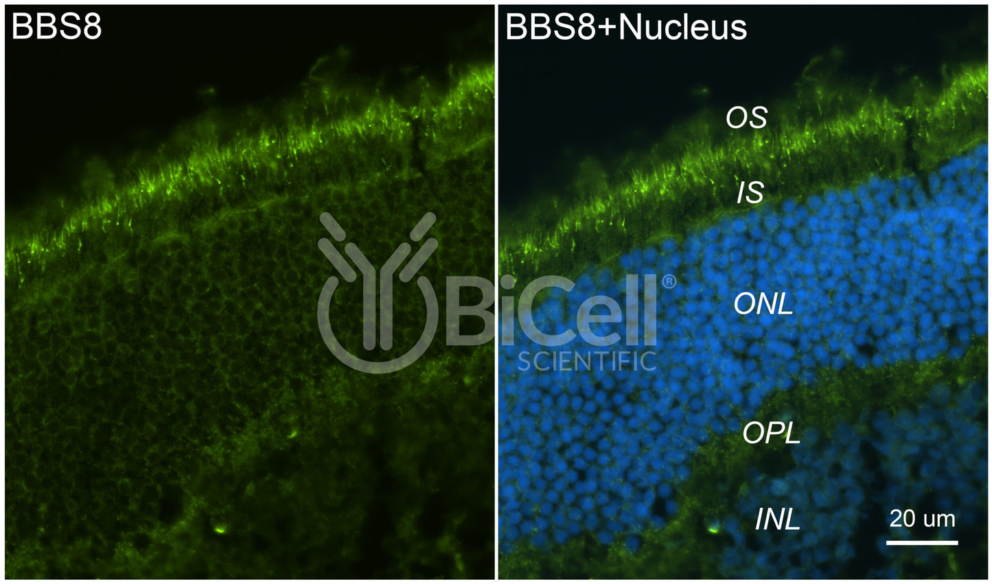 BBS8 (TTC8) Antibody