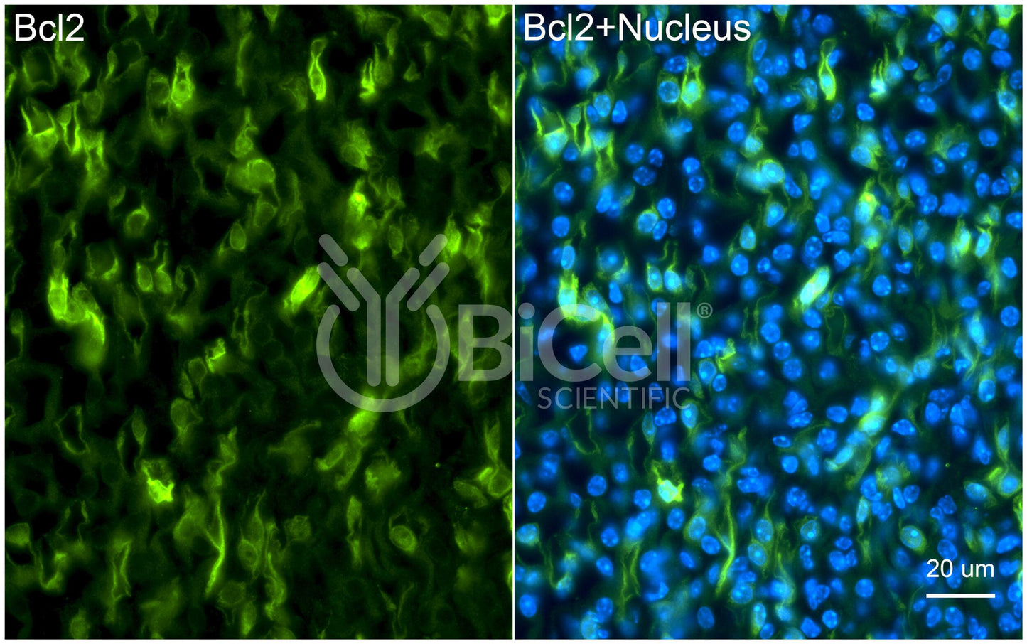 BCL2 Antibody