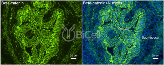 Beta-catenin (Ctnnb1) Antibody - FFPE Validated