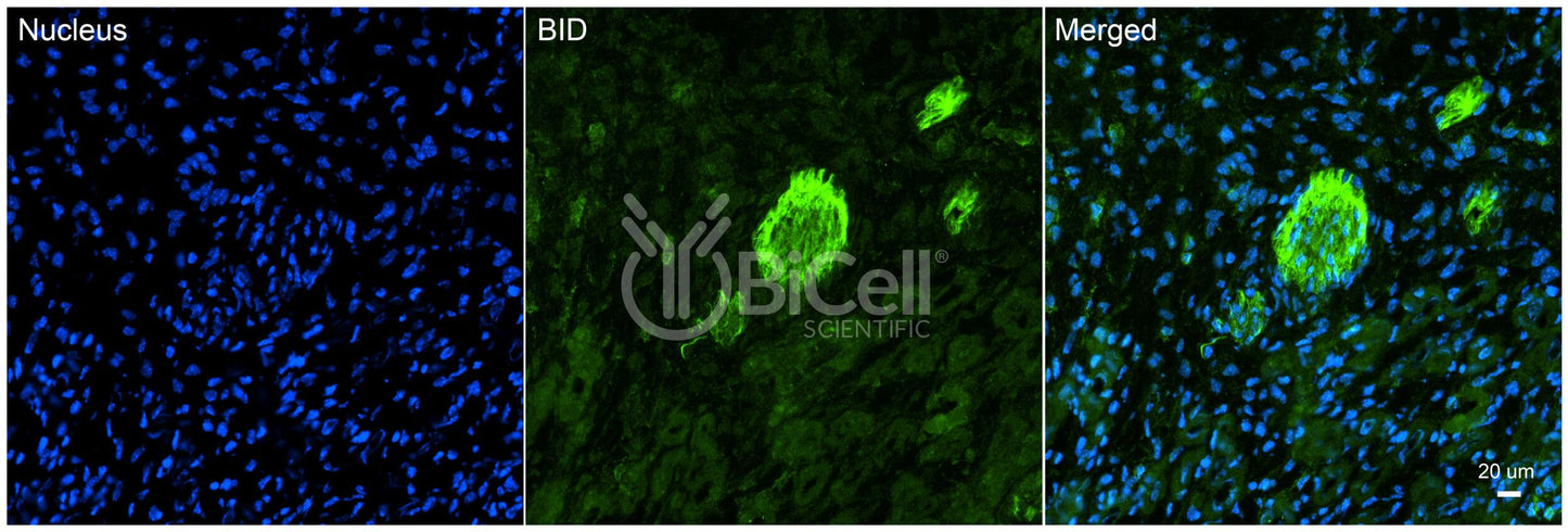 BID Antibody - FFPE Validated