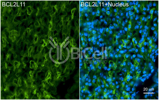BCL2L11 (BAM or BIM) Antibody - Western Blot Validated