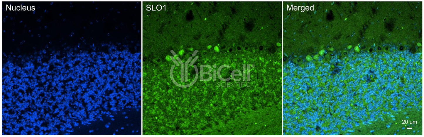 KCNMA1 (SLO1 or MaxiK or KCa1.1) Antibody