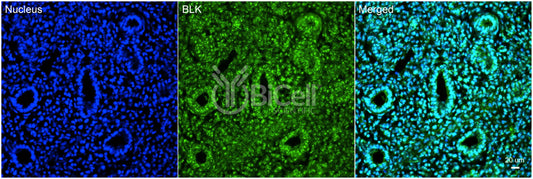 BLK Antibody