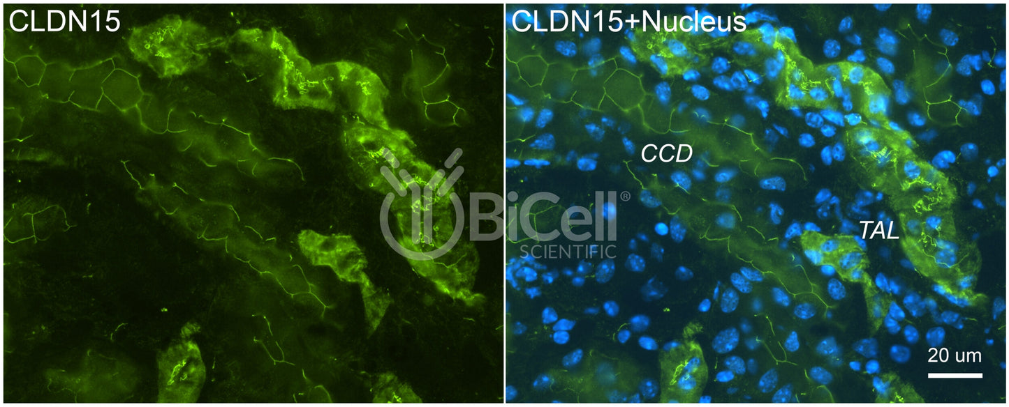 Claudin-15 (CLDN15) Antibody - FFPE Validated