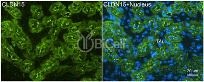 Claudin-15 (CLDN15) Antibody - FFPE Validated