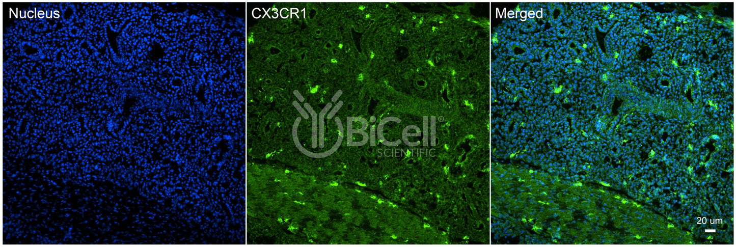 CX3CR1 (CCRL1 or GPR13) Antibody - FFPE Validated