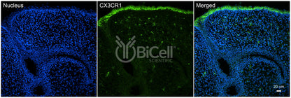 CX3CR1 (CCRL1 or GPR13) Antibody