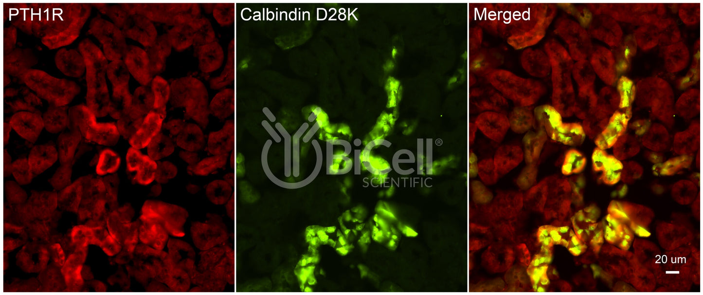 Calbindin-1 (CALB1 or Calbindin D-28K) Antibody - FFPE Validated