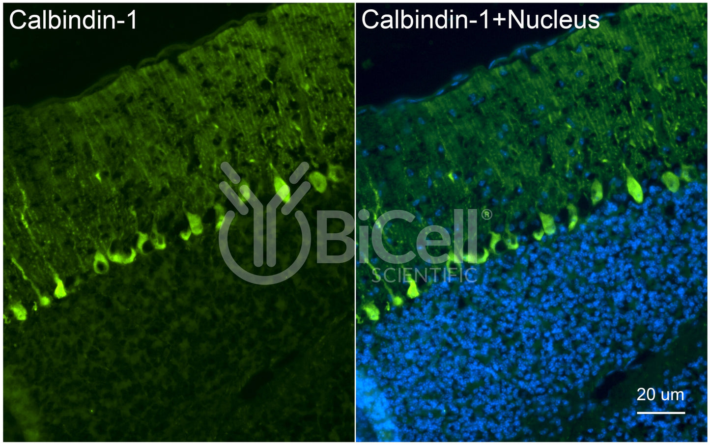 Calbindin-1 (CALB1 or Calbindin D-28K) Antibody - FFPE Validated