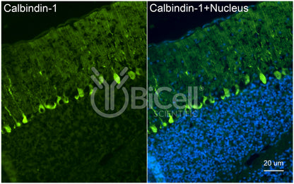 Calbindin-1 (CALB1 or Calbindin D-28K) Antibody