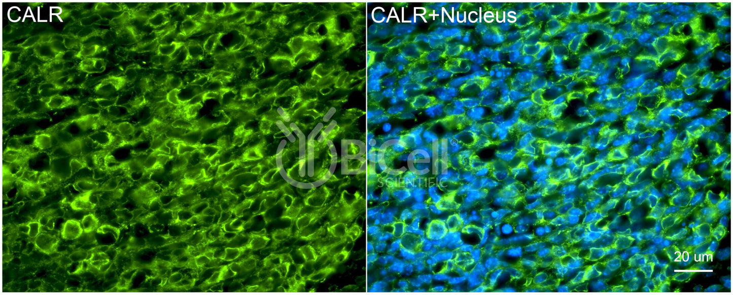 Calreticulin (CALR) Antibody