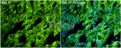 Calreticulin (CALR) Antibody