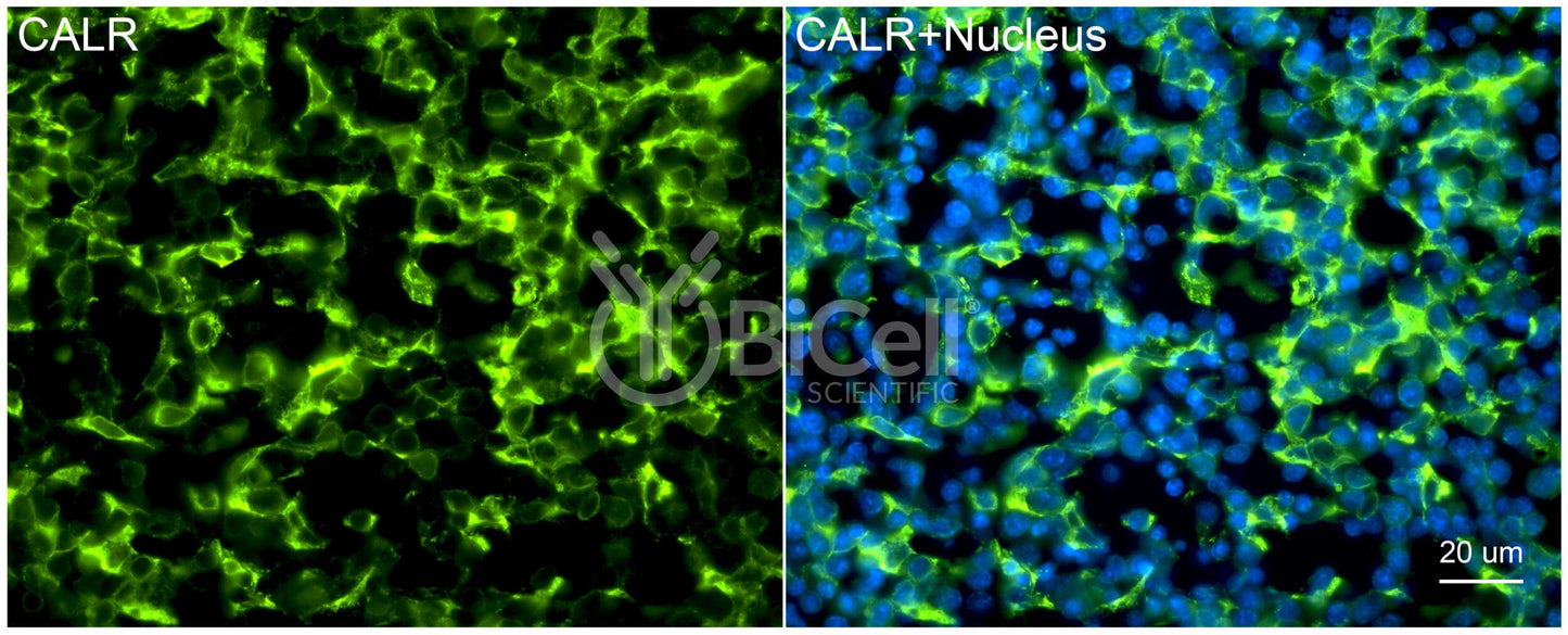 Calreticulin (CALR) Antibody - FFPE Validated