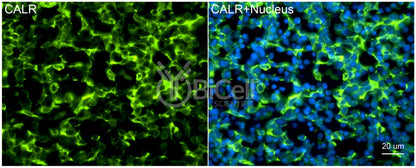 Calreticulin (CALR) Antibody - FFPE Validated