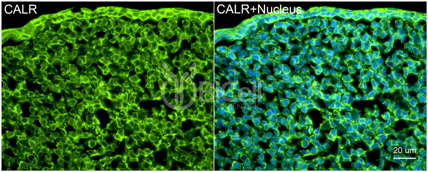Calreticulin (CALR) Antibody
