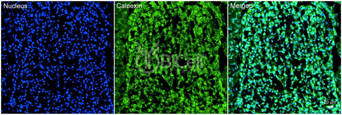 Calnexin (CANX) Antibody